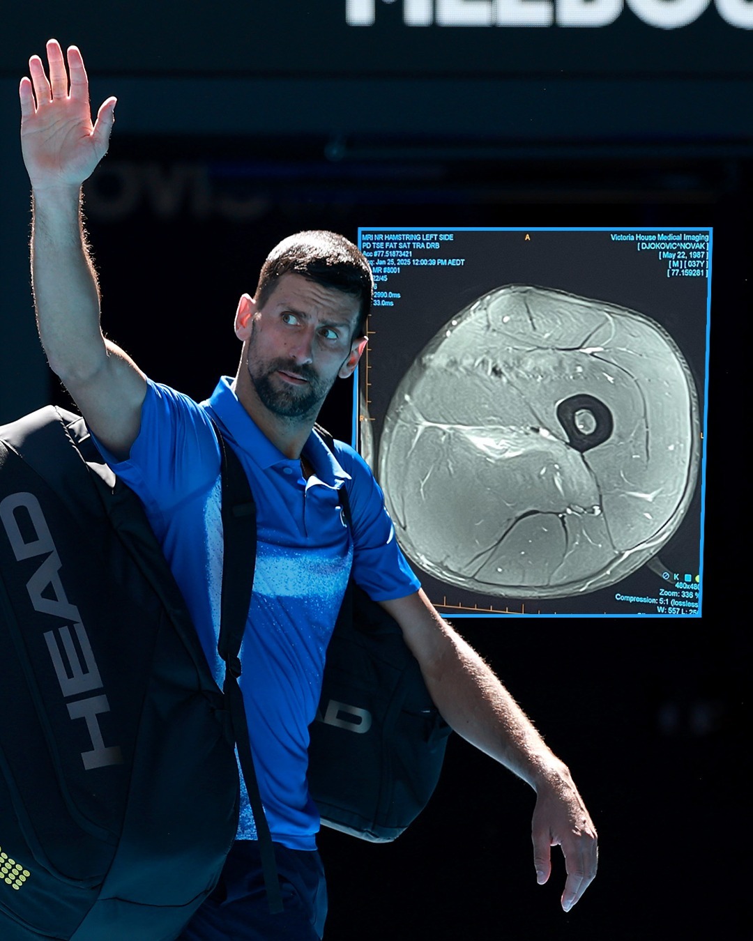 包含ATP总决赛翻盘戴维斯杯,德约科维奇刷新纪录的词条 包含ATP总决赛翻盘戴维斯杯,德约科维奇刷新纪录的词条